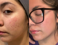 simple skin care routine results in healthy, glowing skin